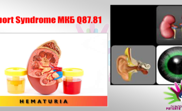 Ретки бубрежни заболувања: Алпортов синдром
